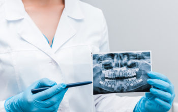 Ortodonista ukazuje perom na rtg snímku postavenie zubov